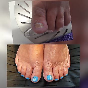 Mooie teen nagels Mirjam's Nagelstudio Beerta